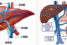 【懋式百科全书】肝门静脉CTV扫描技术-器械之心