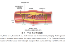 一读懂血管内超声（IVUS）技术及市场-器械之心