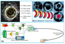 血管内超声（IVUS）的器械构成及技术趋势-器械之心