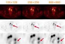 一文读懂PET空间分辨率-器械之心