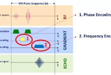 MR基础知识 -- 序列成像原理(二)-器械之心