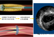 血管内超声(IVUS)工作原理及基础识图-器械之心