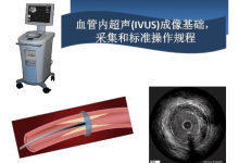 内置马达式血管内超声（IVUS）探头的设计与研制-器械之心