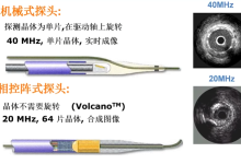 IVUS基本原理和临床应用-器械之心