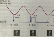 放射治疗技术的应用及进展-器械之心