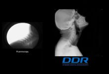 柯尼卡美能达医疗—DDR 骨科应用-器械之心