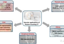 双源光子计数CT：血管应用临床概述-器械之心