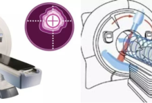 TOMO螺旋断层放疗系统：技术革新与临床应用挑战-器械之心
