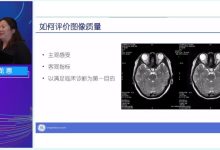 磁共振成像参数优化与质量控制-器械之心