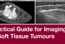 【专业书籍】软组织成像指南-器械之心