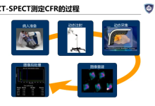 CZT心脏专用SPECT心肌血流定量技术临床应用中国专家共识-器械之心