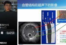 IVUS使用教程 浙江大学医学院附属邵逸夫医院黄翯主任-器械之心